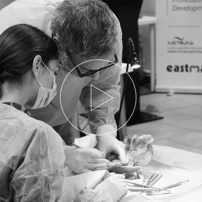 Peri-implantitis Photo Gallery